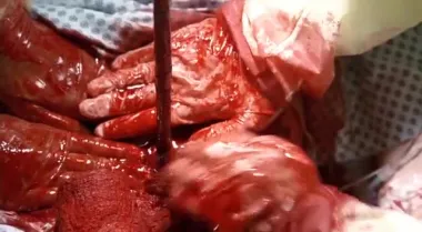 La vida después de la muerte